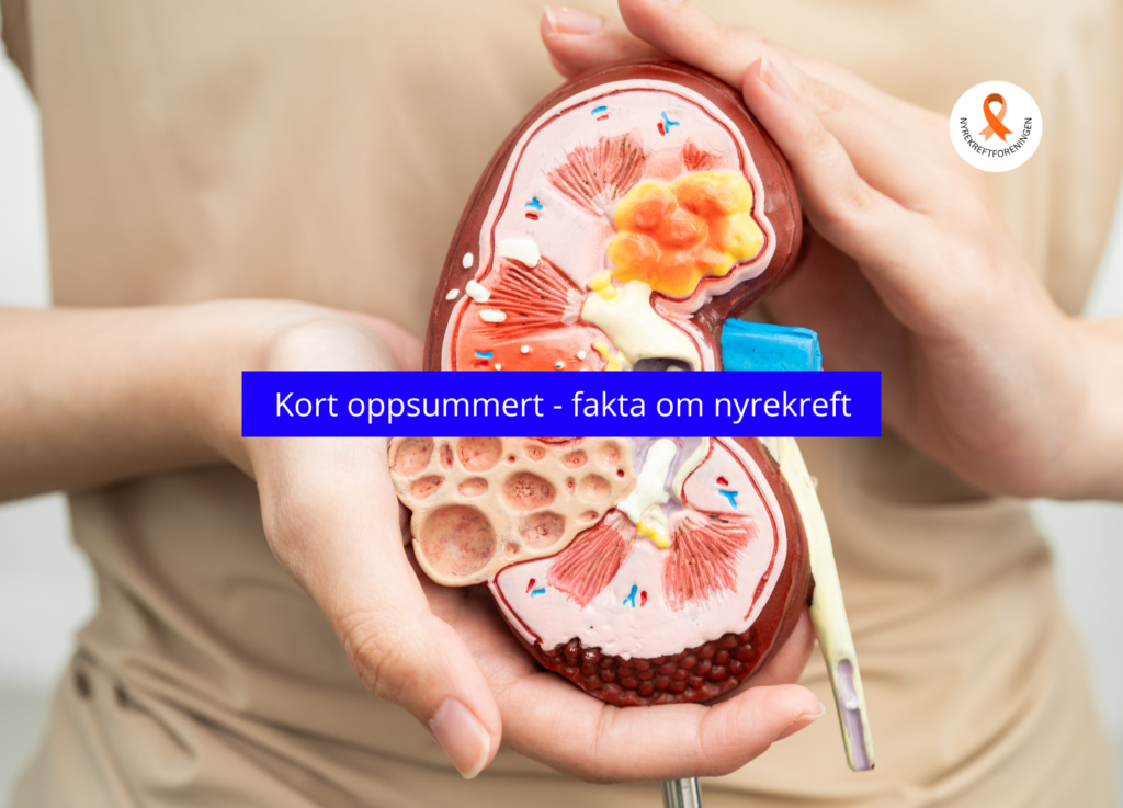 illustrasjonsfoto: to hender som holder en nyre av plastikk
